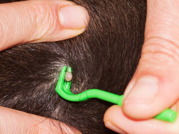 zecca viene rimossa dalla testa con l'utilizzo di pinzette specifiche