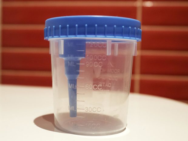 contenitore per la raccolta delle urine