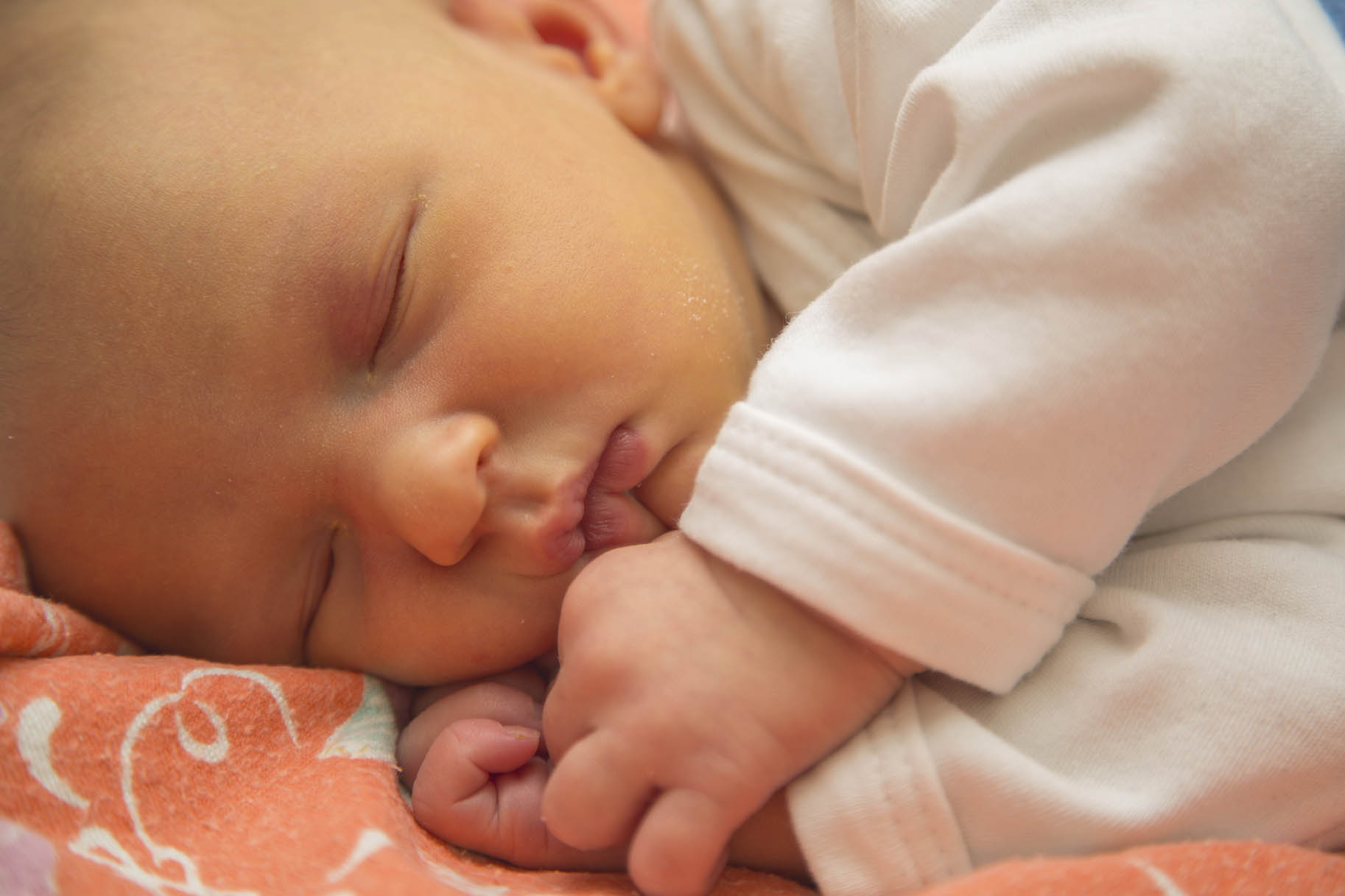 neonato affetto da ittero dorme tranquillo