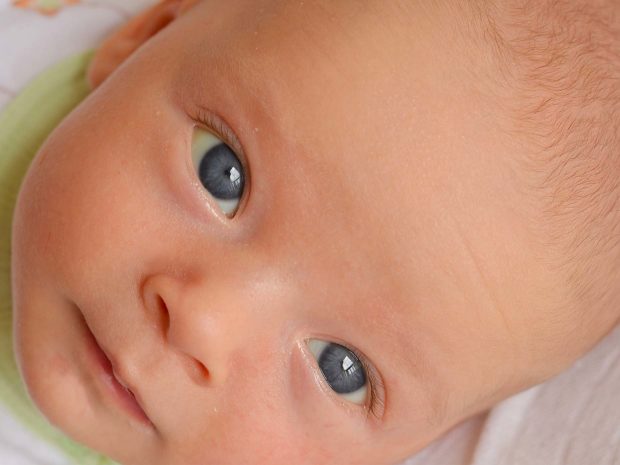 primo piano volto neonato affetto da ittero
