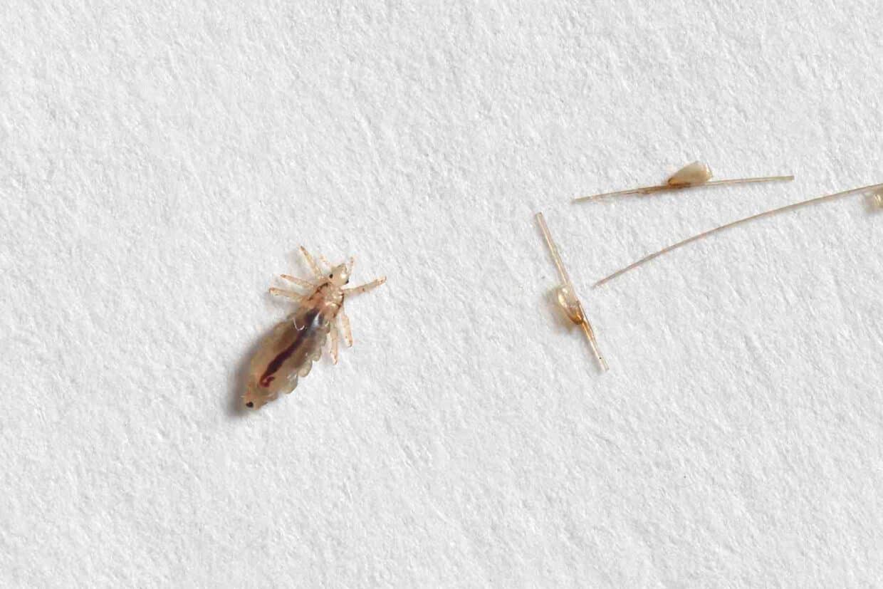 Pidocchio del cuoio capelluto e lendini (uova): ingrandimento